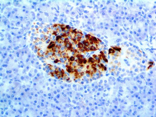 IHC of Somatostatin Rpab on an FFPE Pancreas Tissue